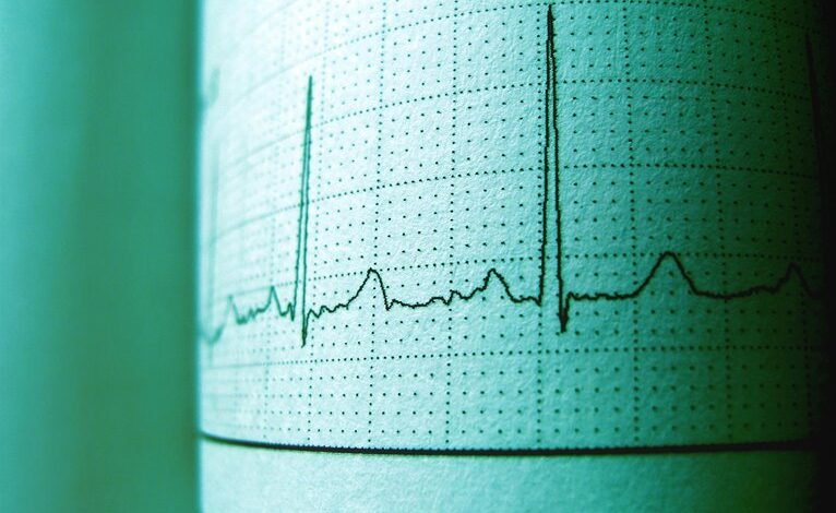 trace dial origin number